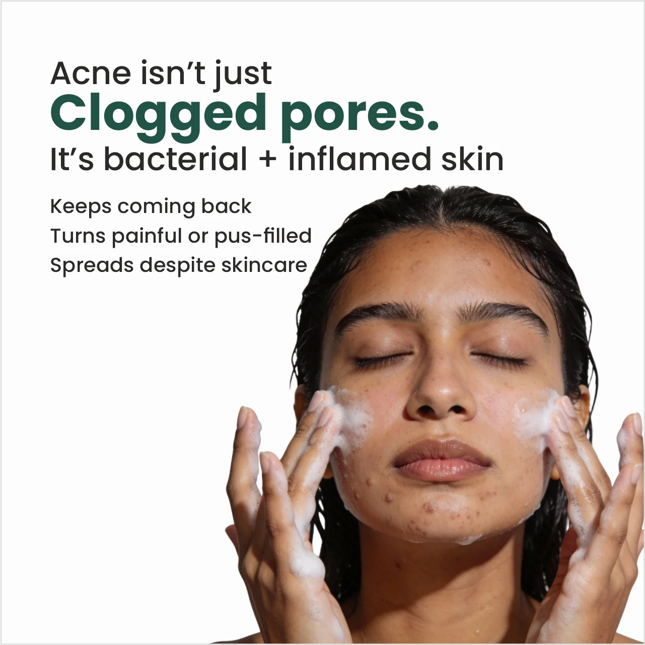 N0.1 Dermaclar Oxy Acne Cleanser - Image 4