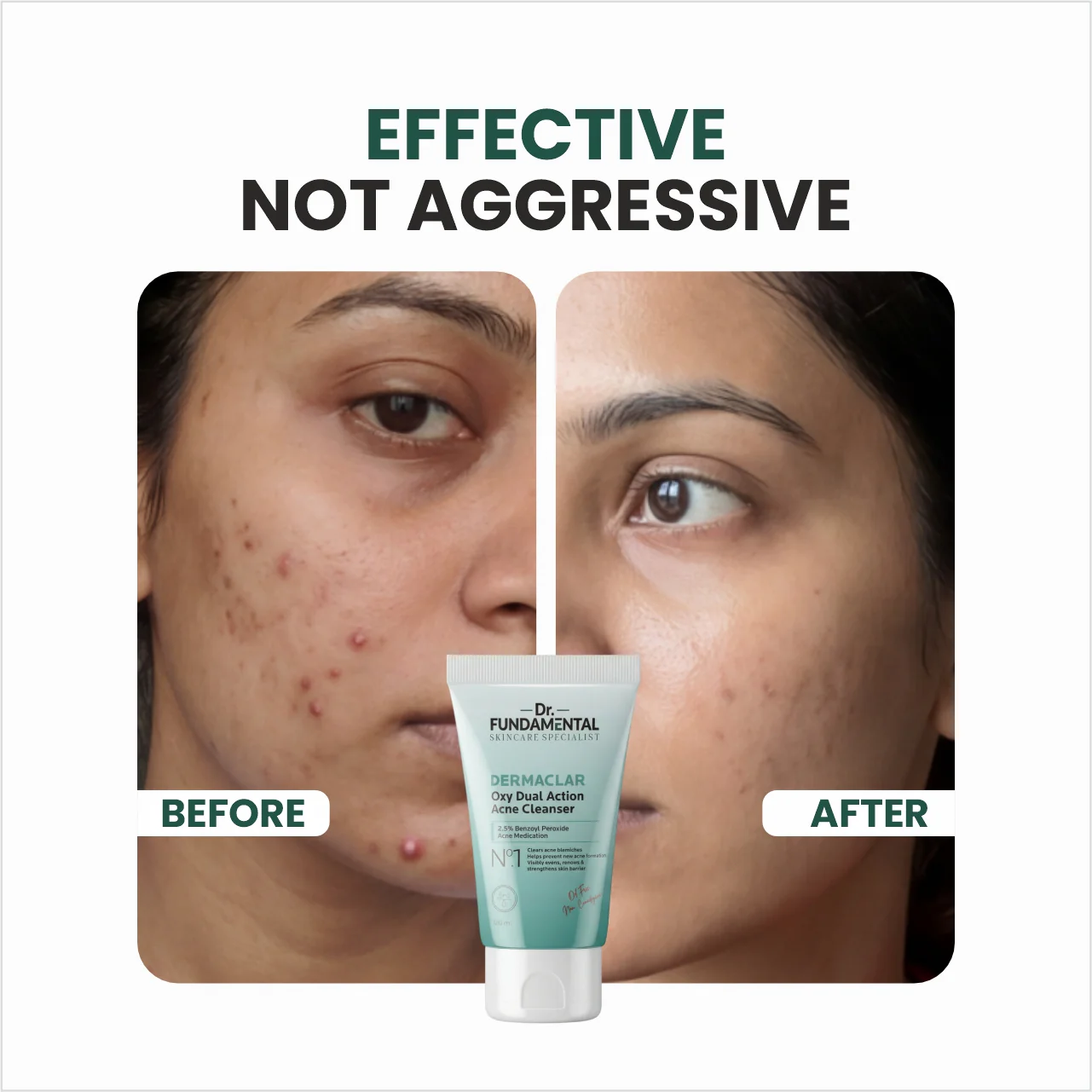 N0.1 Dermaclar Oxy Acne Cleanser - Image 5